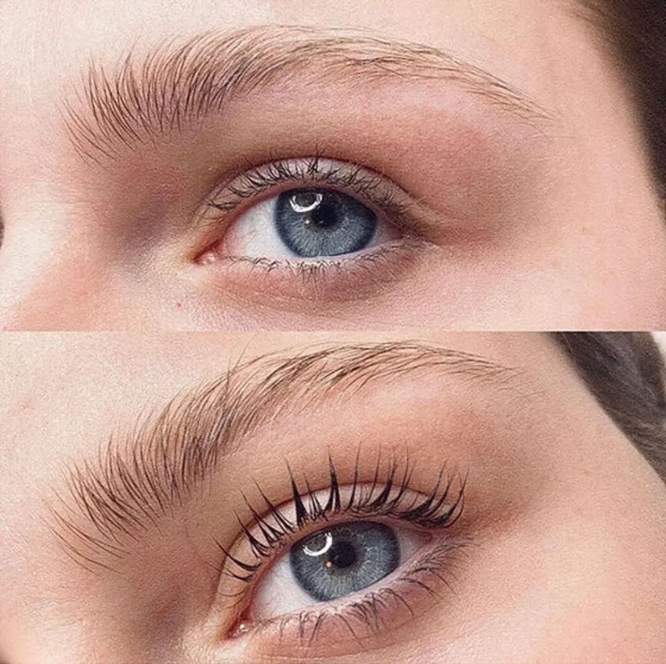 Are Blonde Eyelashes Rare Or Common?