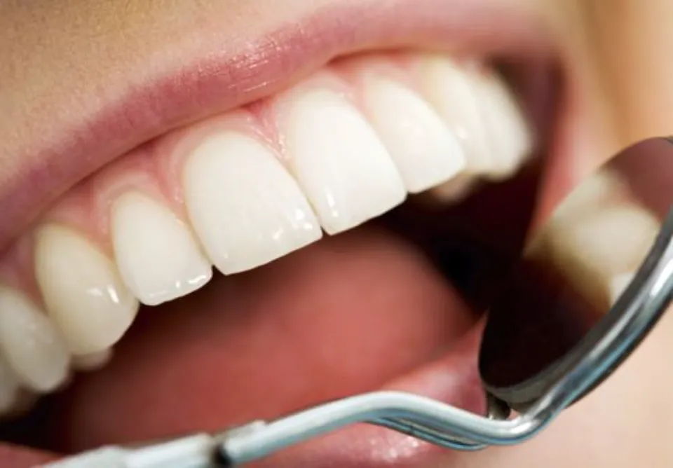 How Long Can Cavities Untreated - Everything You Should Know